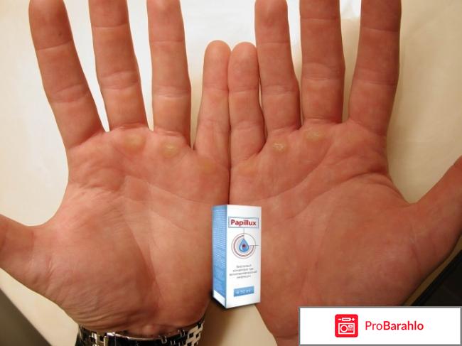 Papillux средство от папиллом и бородавок обман