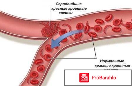 Основные симптомы дефицита железа в организме 