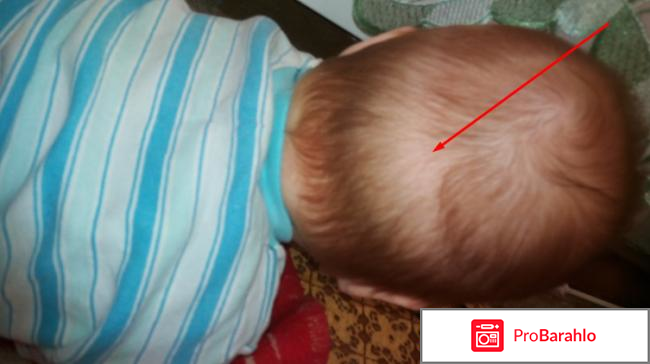 Аквадетрим инструкция по применению цена отзывы отрицательные отзывы