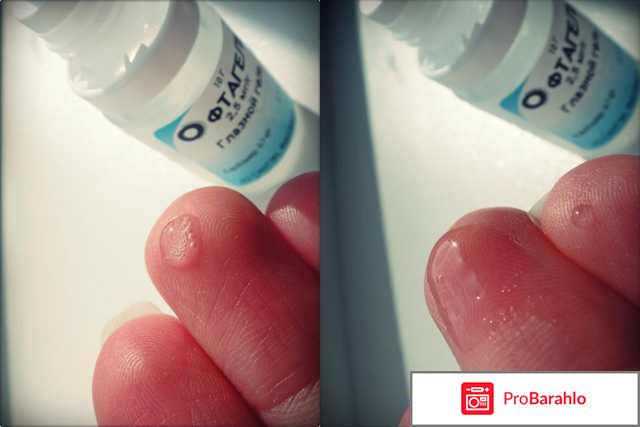 Офтагель глазные капли инструкция цена отзывы аналоги обман