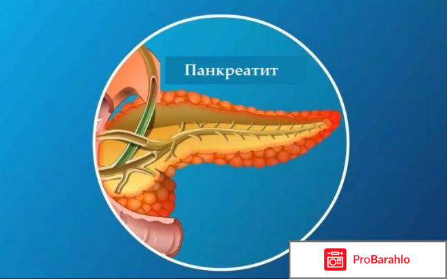 Поджелудочная железа симптомы заболевания обман