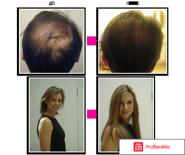 Для быстрого роста волос 