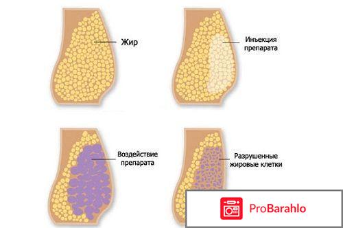 Липолитики для подбородка отзывы отрицательные отзывы