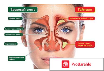 Левофлоксацин при гайморите 