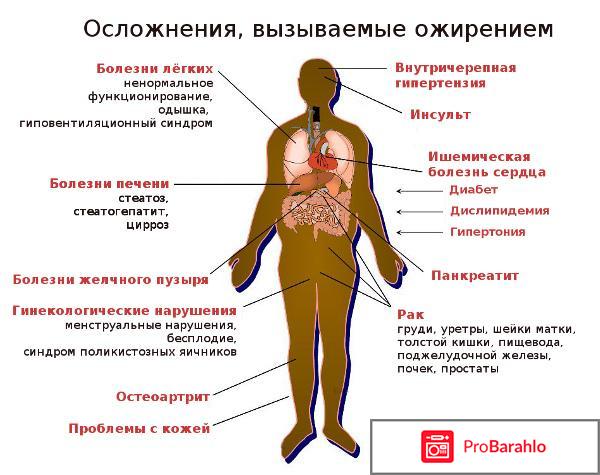 Болезни вызывающие ожирение отрицательные отзывы