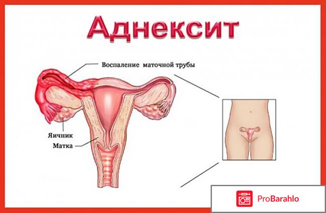 Болит низ живота и выделения отзывы владельцев