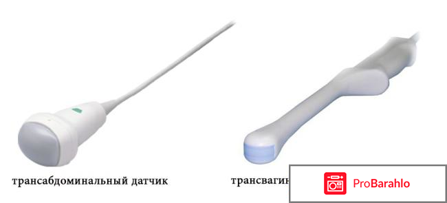 Узи матки подготовка к процедуре 