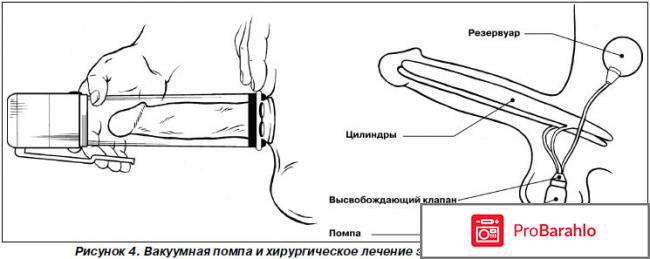 Помпа для мужчин отзывы обман