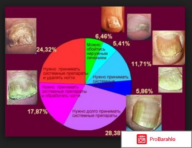 Лоцерил лак для ногтей отрицательные отзывы