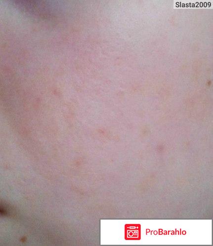 Отзывы клензит с обман