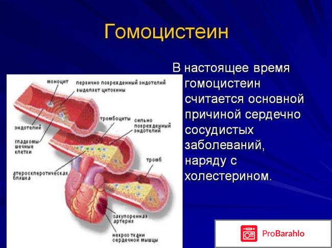 Гомоцистеин повышен 