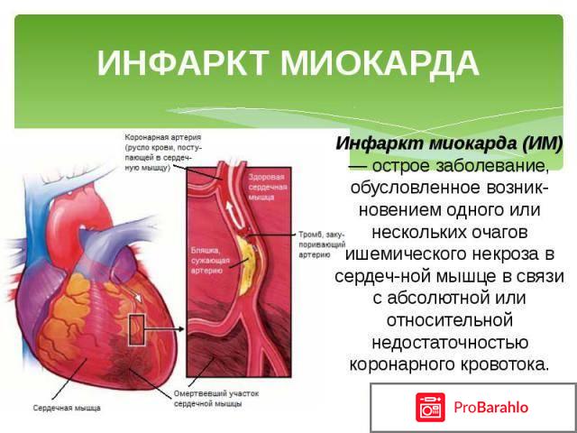 Колет сердце отрицательные отзывы