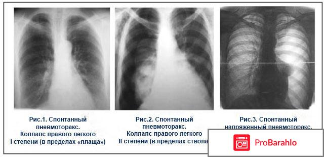 Арина шумакова отрицательные отзывы обман