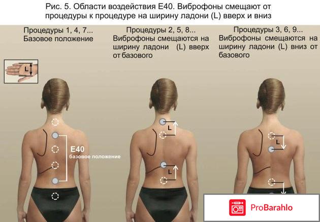 Виброакустический аппарат витафон обман
