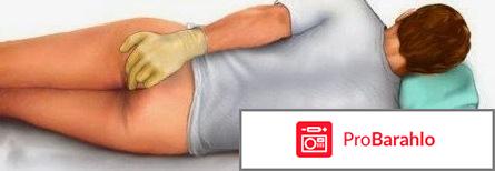 Поговорим об интимном. Геморрой – решение проблемы. отрицательные отзывы