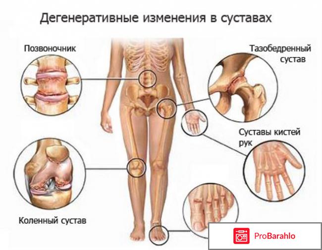 Структум инструкция по применению цена аналоги 