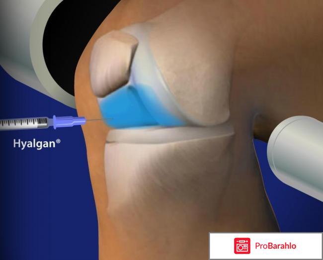Гиалган инструкция по применению цена обман