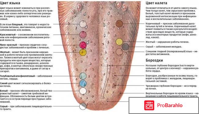 Налет на языке: причины, фото отрицательные отзывы