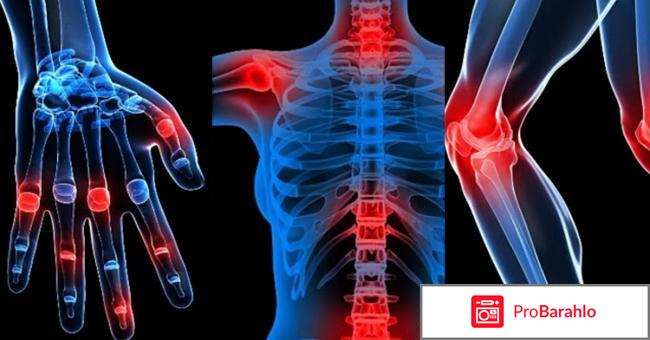 Хондрогард мазь инструкция по применению цена отзывы обман