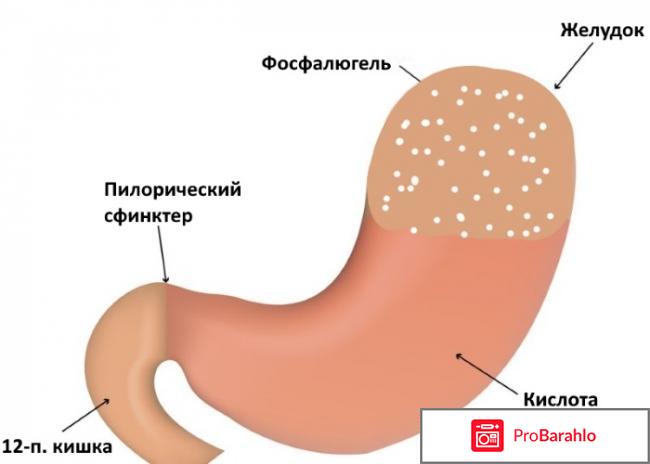 Фосфалюгель как принимать отрицательные отзывы