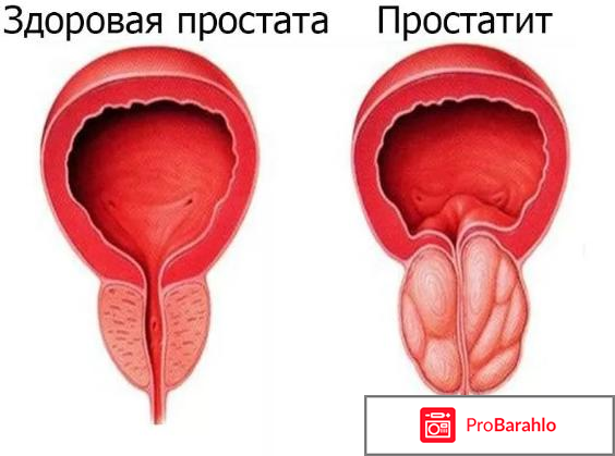 Простодин развод реальные отзывы отрицательные отзывы