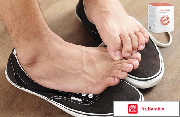 Экзомин (Exomin) фото