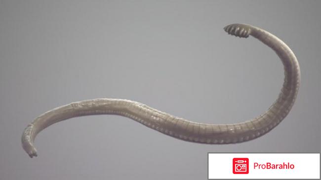 Анкилостома у человека симптомы лечение отрицательные отзывы