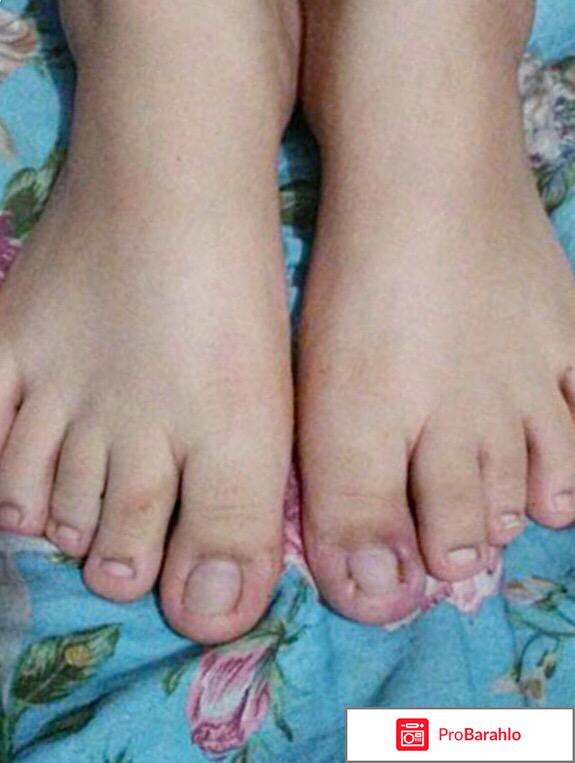 Микозан от грибка ногтей отзывы цена реальные отзывы