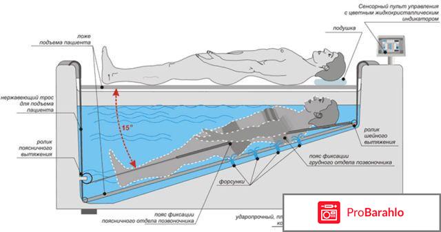 Подводное вытяжение позвоночника обман