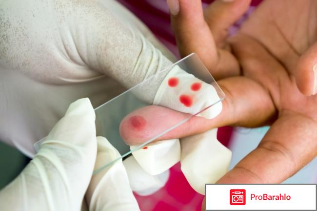 Показатель соэ в анализе крови обман