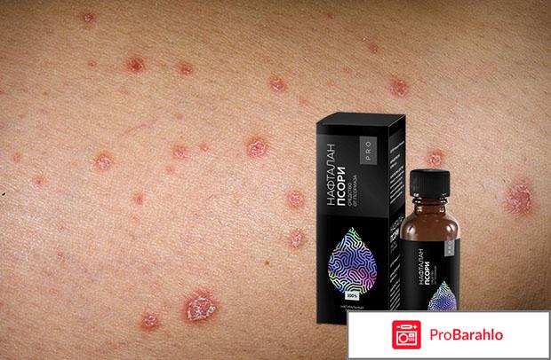 Нафталан Псори PRO мазь от псориаза: цена, отзывы отрицательные отзывы