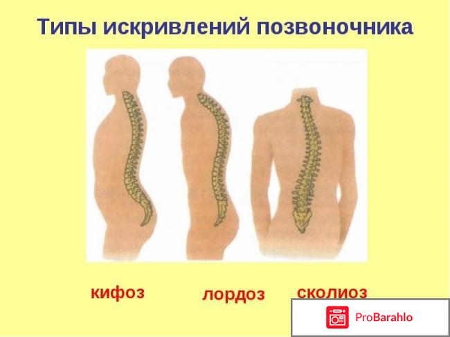 Магнитный корректор осанки posture support 