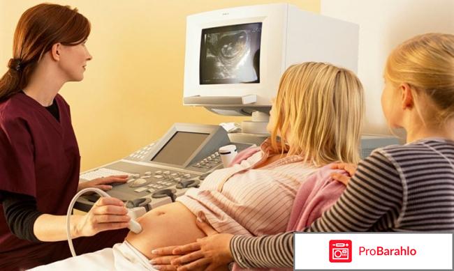 Вредно ли делать узи отрицательные отзывы