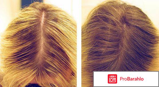 ActiRost (Актирост) отрицательные отзывы