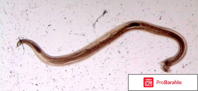 Анкилостома у человека симптомы лечение обман