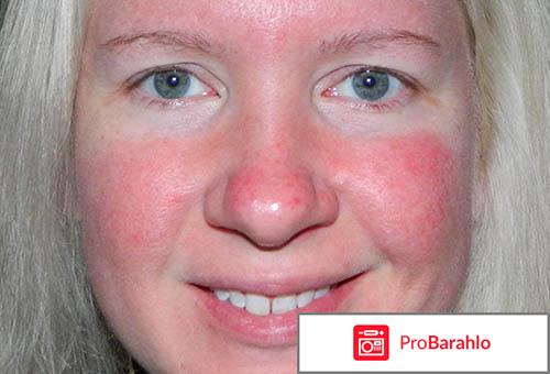 Причины и как избавиться от красного лица обман