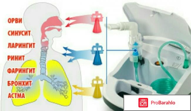 Ld 210c отрицательные отзывы