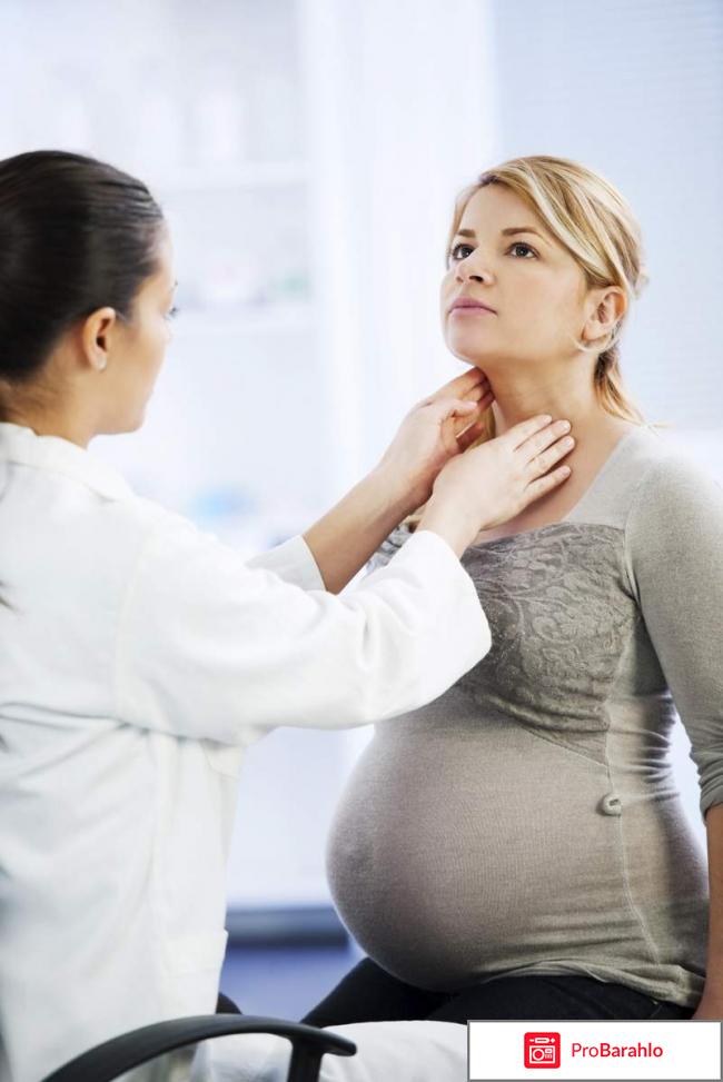 Гипертиреоз беременных отрицательные отзывы