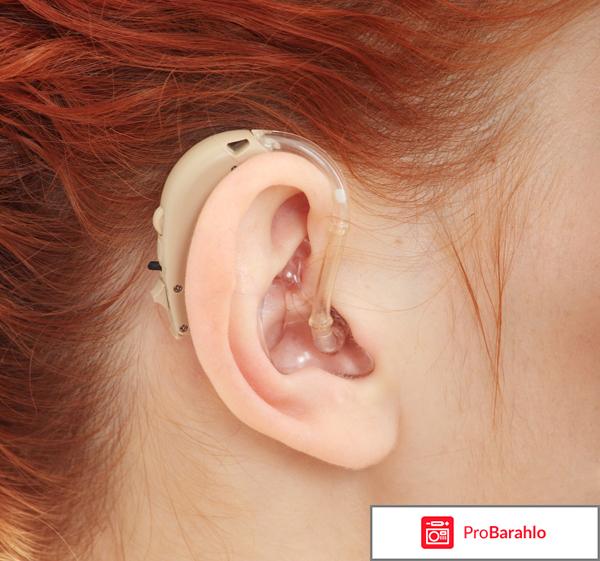 Слуховой аппарат обман