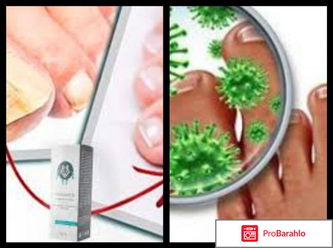 Варанга отрицательные отзывы