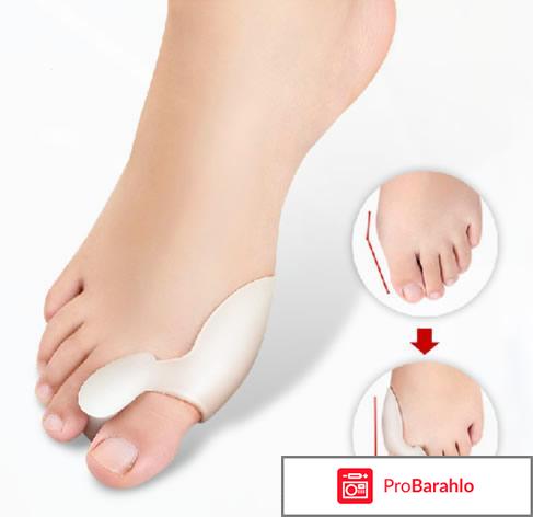 Valgus pro реальные отзывы отрицательные отзывы