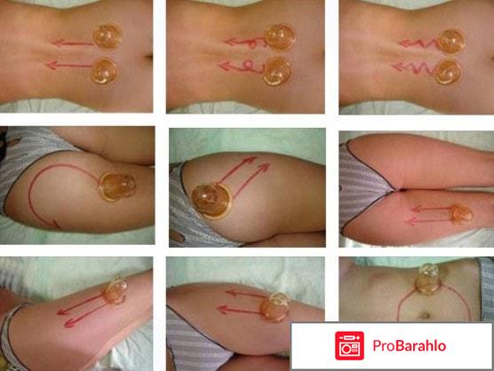 Вакуумный массаж отзывы фото обман