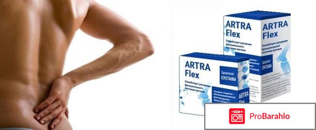 ARTRA Flex капсулы для суставов реальные отзывы