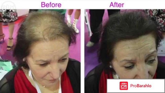 Загуститель волос отрицательные отзывы