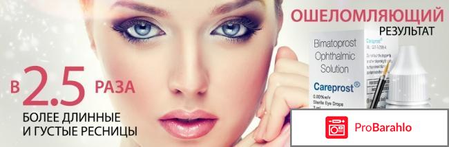 Careprost отзывы врачей обман
