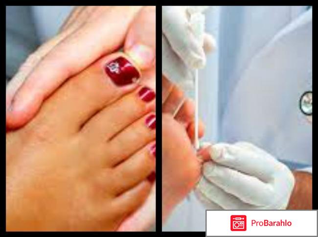 Junlei (Джунлей) от грибка: цена, отзывы, купить за 990 руб. 