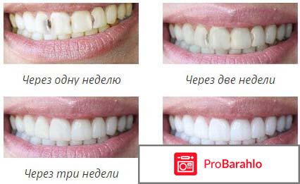 DENTA SEAL отрицательные отзывы