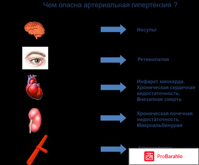 Гиперолект (Giperolect) обман