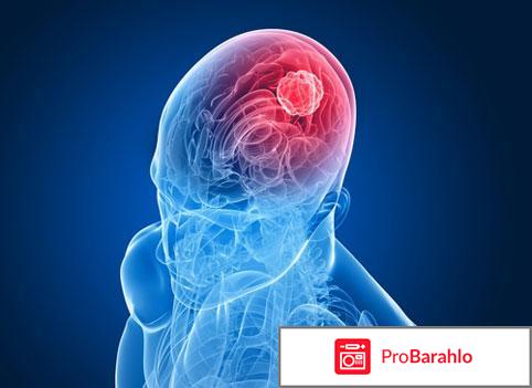 Temodal отрицательные отзывы