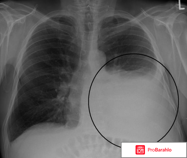 Чкадуа тамара зурабовна отрицательные отзывы отрицательные отзывы